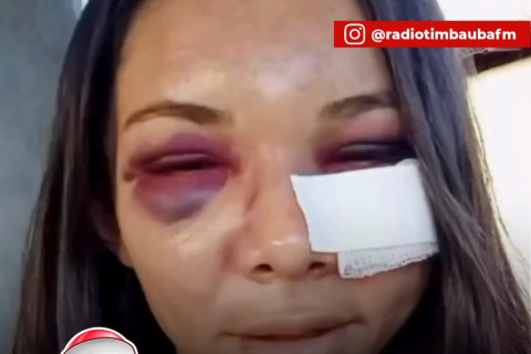 Jovem relata agressão brutal do companheiro no Piauí e diz que violência foi inesperada