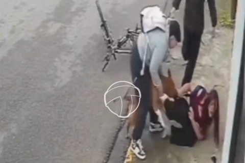 Câmeras flagram momento em que jovem é atacada por pitbull em Imbituba